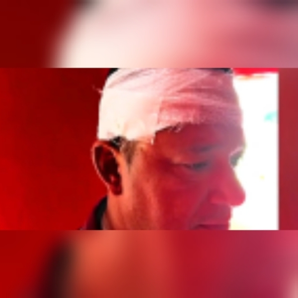 Docente atacó a pedradas a su ex tras verlo con su nuevo amor