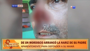 Joven arranca la nariz a su padre en defensa de su madre