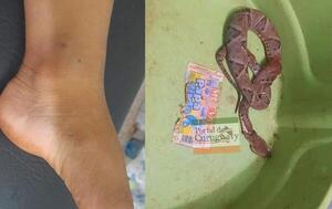 Trasladan a Asunción a niño de 3 años luego de ser picado por venenosa víbora en Curuguaty – Prensa 5