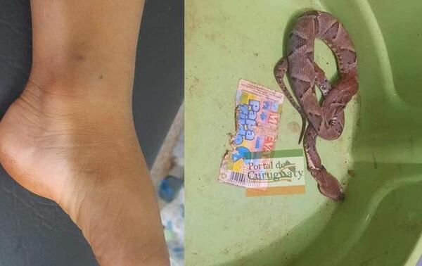Trasladan a Asunción a niño de 3 años luego de ser picado por venenosa víbora en Curuguaty – Prensa 5