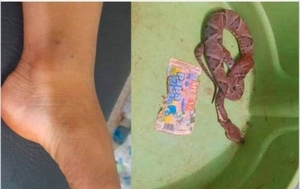 Niño de 3 años es el quinto caso de picadura de víbora en Curuguaty - Noticiero Paraguay