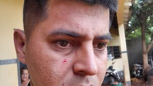Dos mujeres y un joven detenidos por supuesta agresión a policía
