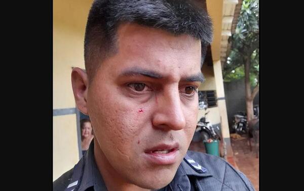 Dos mujeres y un joven detenidos por supuesta agresión a policía en Ciudad del Este – Prensa 5