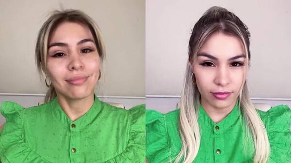 Diario HOY | Nadia Portillo mostró antes y después de su depresión: "La foto me delataba"