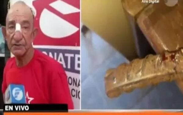 Atacó a su padre de 85 años con una varilla de hierro en Misiones – Prensa 5