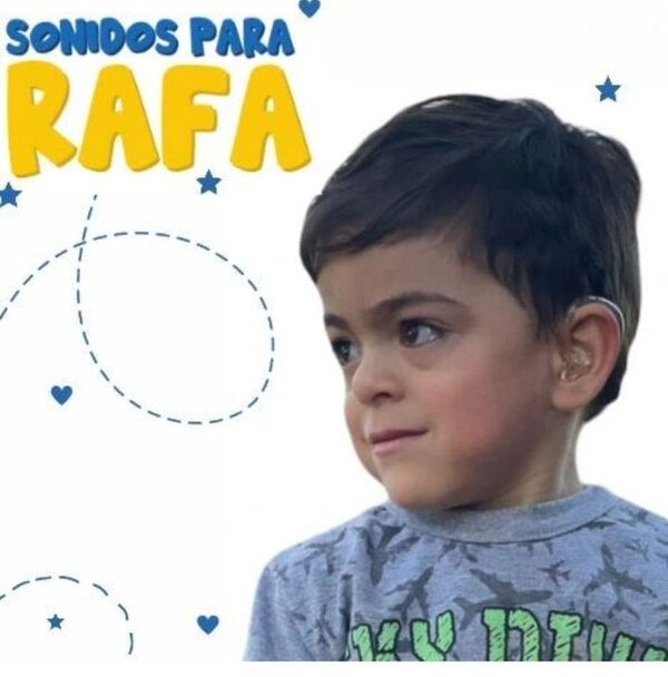 Sonidos para Rafa: niño necesita implante coclear