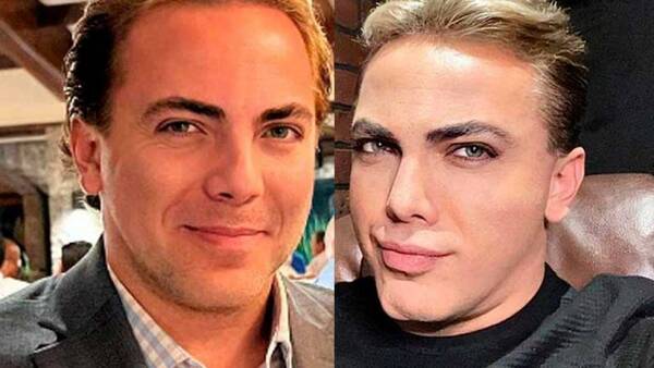 ¡Es otro! ¿Qué se hizo Cristian Castro en la cara?