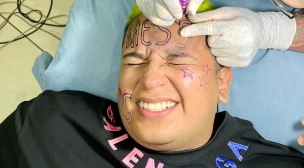 Se tatuó “Messi” en la frente cuando Argentina ganó el Mundial pero ya se arrepintió - Radio Imperio