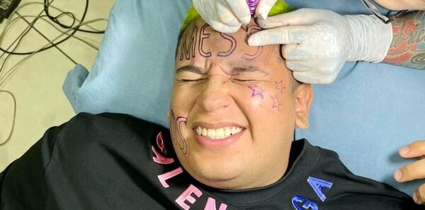 Se tatuó “Messi” en la frente cuando Argentina ganó el Mundial pero ya se arrepintió