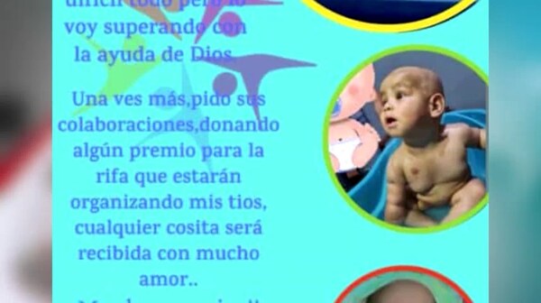 Todos por Mateo, piden ayuda para salvar la vida de un niño