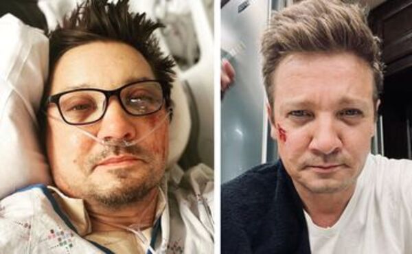 Aparece primera imagen del acto Jeremy Renner tras su accidente