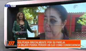 Mujer podría perder un ojo tras ataque de su pareja - Paraguaype.com
