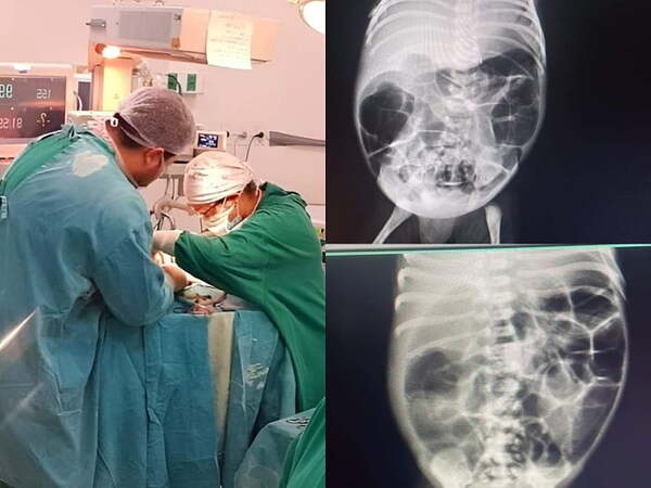 Exitosa operación a recién nacido en el Hospital de Coronel Oviedo - Noticiero Paraguay