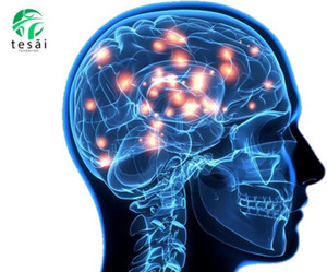 Fundación Tesãi advierte que la pornografía atonta el cerebro | DIARIO PRIMERA PLANA