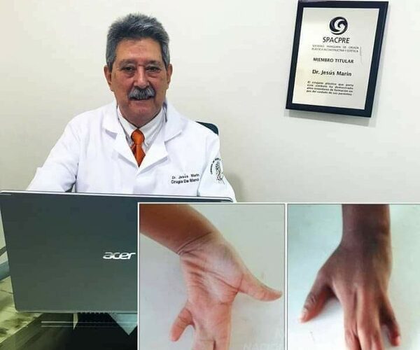 Noble gesto: Doctor operará gratis a hijo de albañil pelado por ladrones