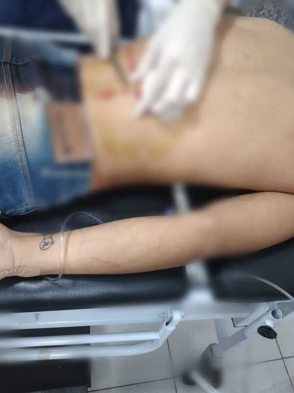 De una estocada perforaron el pulmón a un hombre en el barrio San Pedro