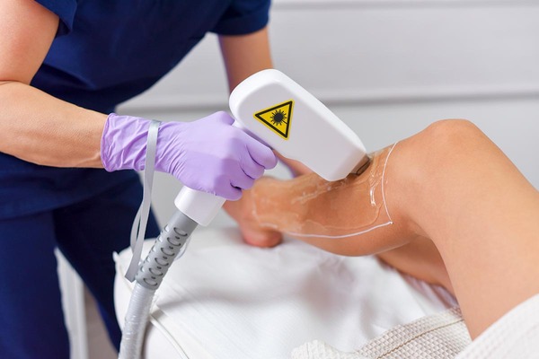 Dermatóloga brinda recomendaciones para iniciar depilación con láser - Unicanal