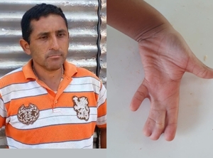 Cirujano operará sin costo al hijo del albañil al que robaron todo su ahorro