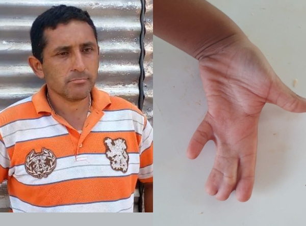 Cirujano operará sin costo al hijo del albañil al que robaron todo su ahorro