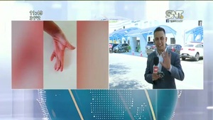 Marcelito tendrá una nueva vida - SNT