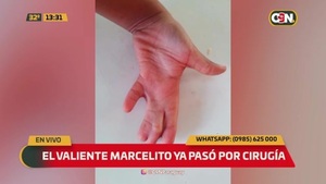 El valiente Marcelito ya pasó por la cirugía - C9N