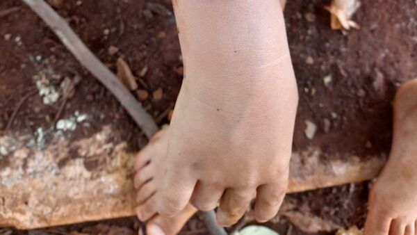 Policía rescata a niño mordido por perro y aparentemente abandonado