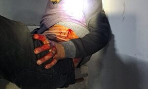 Un hombre balea a un exconvicto que ingresó a su casa para robar – Diario TNPRESS