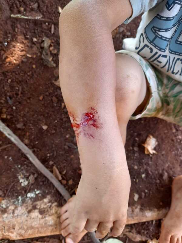 Rescatan a mitã’i mordido por un perro y abandonado en la calle - La Clave
