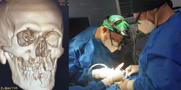 EXITOSA CIRUGÍA MAXILOFACIAL EN EL IPS DE ENCARNACIÓN - Itapúa Noticias