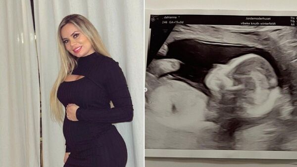 Dahiana Bresanovich revelará si espera una nena o un varón