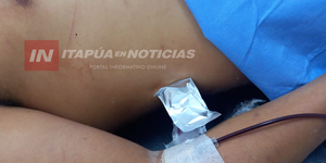 FIESTA DE 15 AÑOS TERMINÓ CON UN APUÑALADO EN ALTO VERÁ - Itapúa Noticias