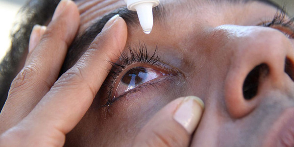CONJUNTIVITIS: SÍNTOMAS, SIGNOS DE ALARMA Y MEDIDAS DE CUIDADO PERSONAL - Itapúa Noticias
