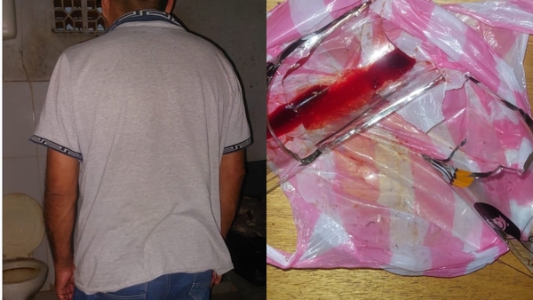 Violento hombre fue detenido tras sup. agredir a su pareja en B° Los Arrabales