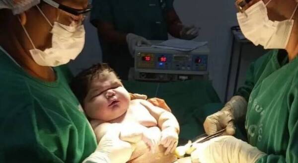 ¡Haihue! Bebé nació con más de 7 kilos y rompió récord