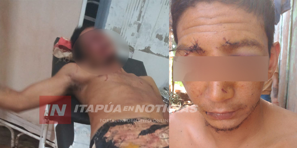 CON UNA BOTELLA DE CERVEZA, DESFIGURARON EL ROSTRO DE UN JOVEN - Itapúa Noticias