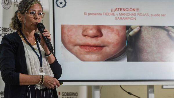 Luego de 22 años, Paraguay confirma caso de sarampión del 2022