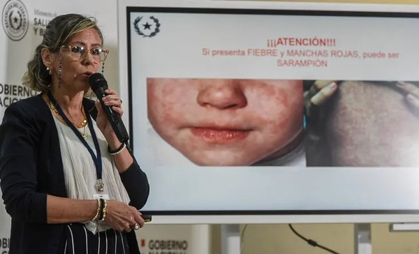 Salud reporta caso de Sarampión en Paraguay después de 22 años