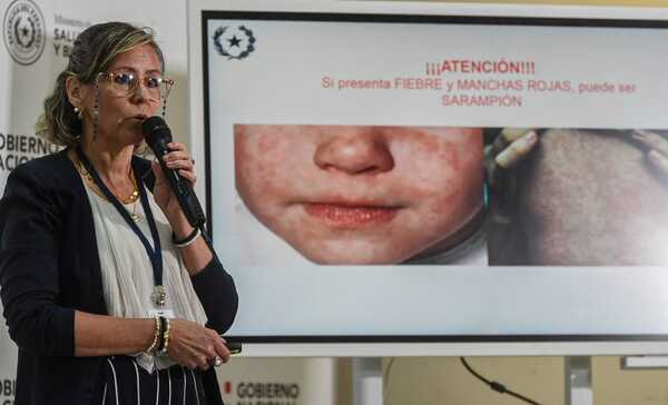 Confirman caso único de sarampión tras 22 años y se intensifica vigilancia