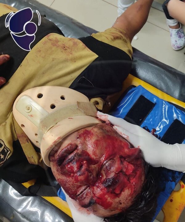 Con graves lesiones en rostro y cabeza por caer de su moto
