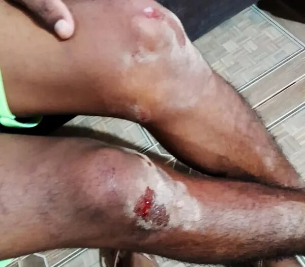 Investigan presunta tortura a un docente indígena en una comisaría - Policiales - ABC Color