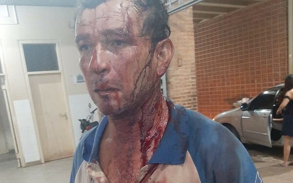 Acusan a esposo de gobernadora de golpear a trabajador: “Me pegó en la cabeza con un garrote”