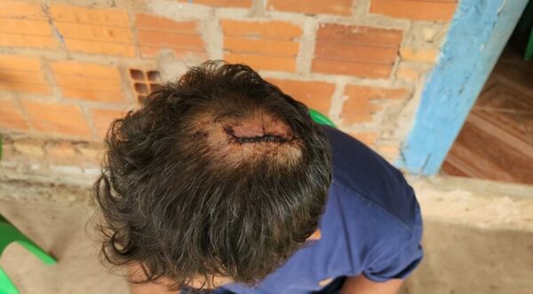 Empleado denuncia que fue brutalmente golpeado por su patrón