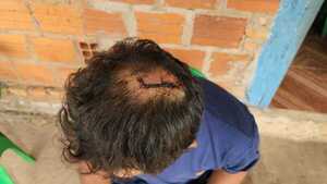 Empleado denuncia que fue brutalmente golpeado por su patrón - Noticiero Paraguay