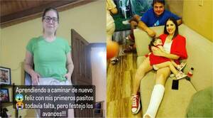 [VIDEO] Esta periodista aprende a caminar de vuelta
