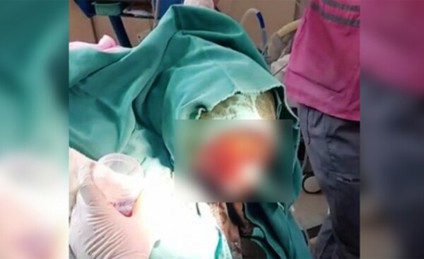 IMPACTANTE: niña de cuatro años tiene la cabeza llena de gusanos
