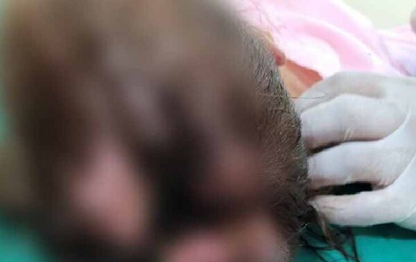 Fiscalía convoca a padres de niña con herida agusanada – Prensa 5