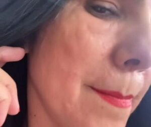 ¡Alergia deja deformada a Norita Rodríguez!
