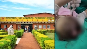 Operan de urgencia a una menor por ataque de gusanos en la cabeza - Noticias Paraguay
