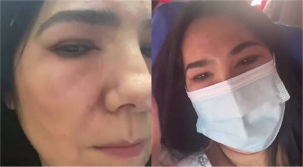 [VIDEO] ¡Norita Rodríguez apareció desfigurada en sus redes!