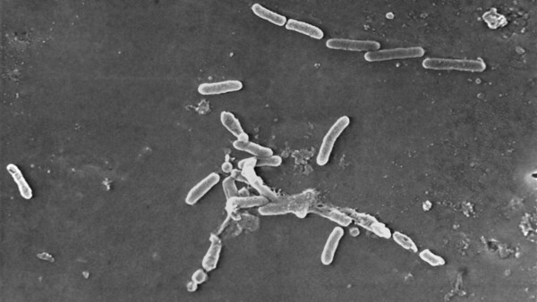 Diario HOY | Sacan del mercado marca de gotas para ojos por brote de bacteria que puede causar ceguera